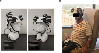 Case Report: End-Stage Recurrent Glioblastoma Treated With a New Noninvasive Non-Contact Oncomagnetic Device